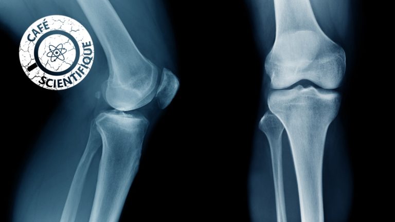 Aaltoja tutkimista, näkemistä ja hoitamista varten